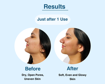 DewDrop Evenness Boost Serum