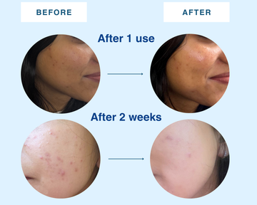 Morning Dew Moisturizer with SPF 15
